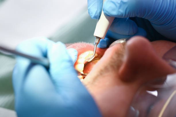 Best Pediatric Emergency Dentist in Melwood, MD